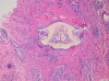 Tick2
