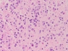 Obraz histologiczny 1