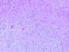 SFT