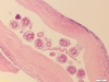 Echinococcus granulosus 2