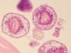 Echinococcus granulosus 3