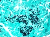Pneumocystis firoveci