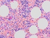 Myelolipoma 40x